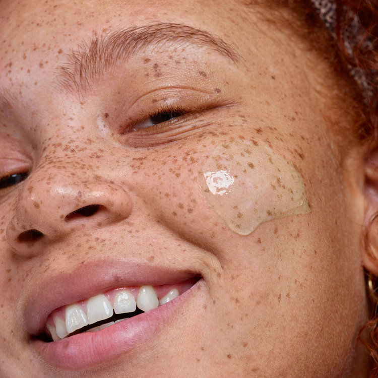 Freckled young woman with Nudeskin Exfoliating product on her face