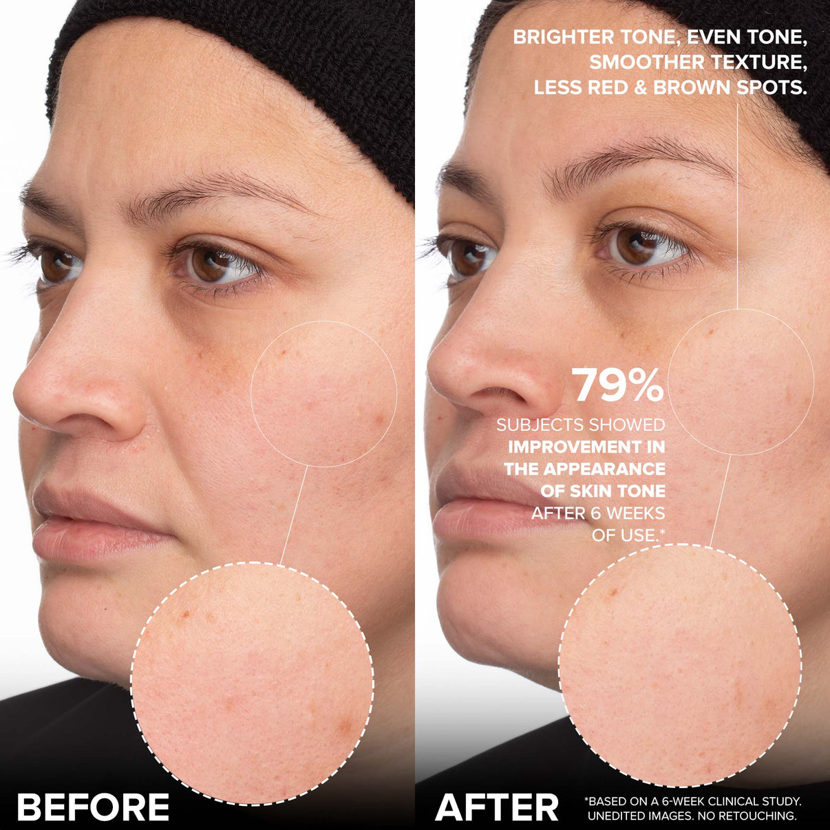 79%の被験者が6週間の使用後に肌の色合いの外観の改善を示しました