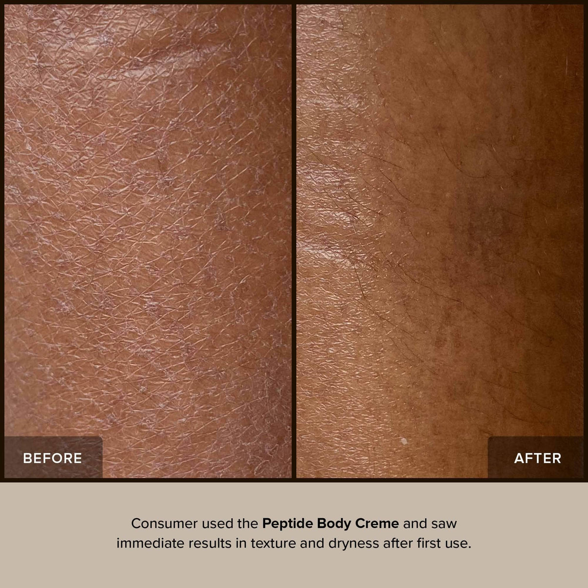 Before and after using Peptide body creme
