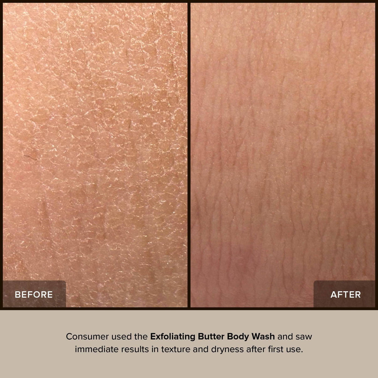 Close up skin before and after wearing exfoliating butter body wash