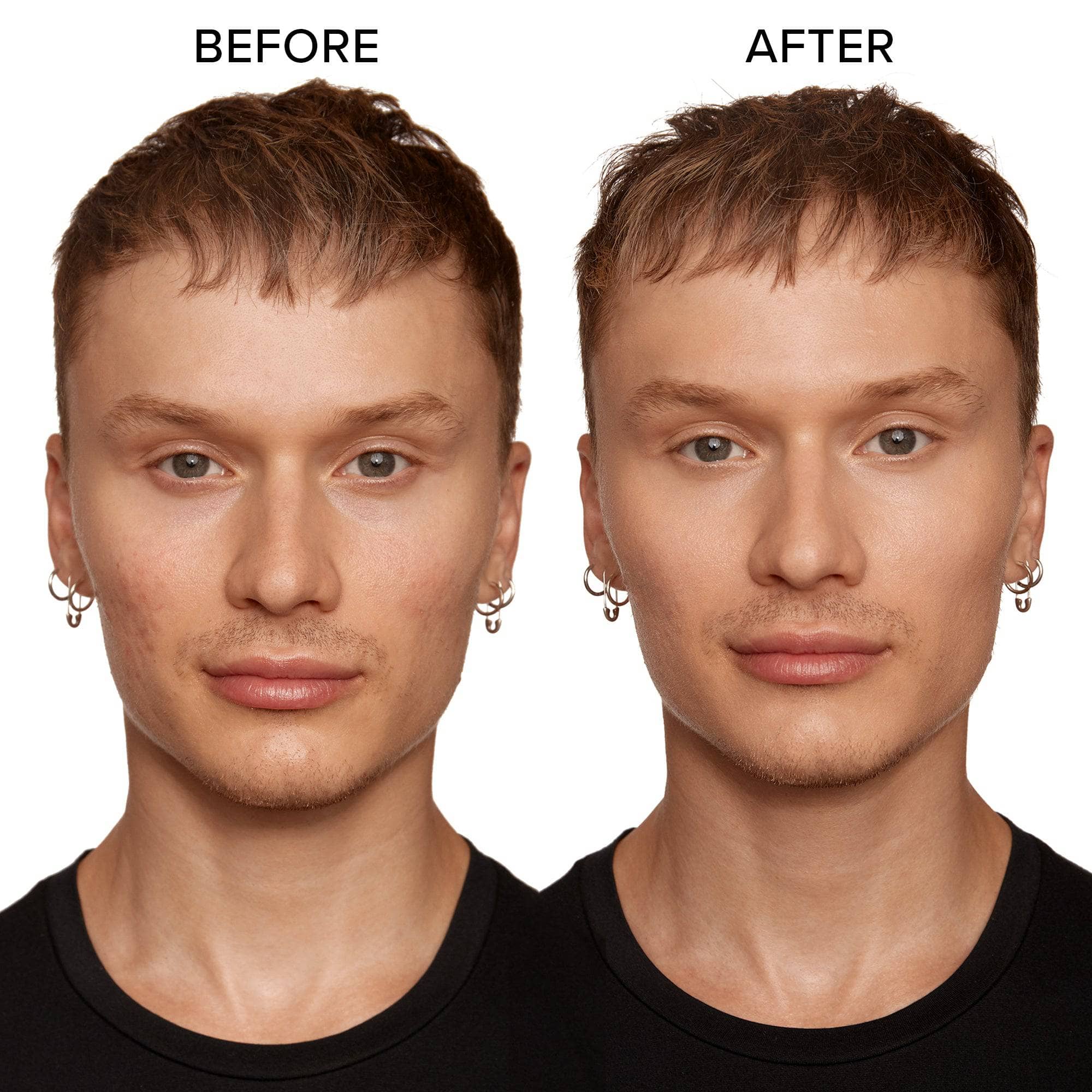 Young man before and after wearing medium4 medium5 medium6 medium7